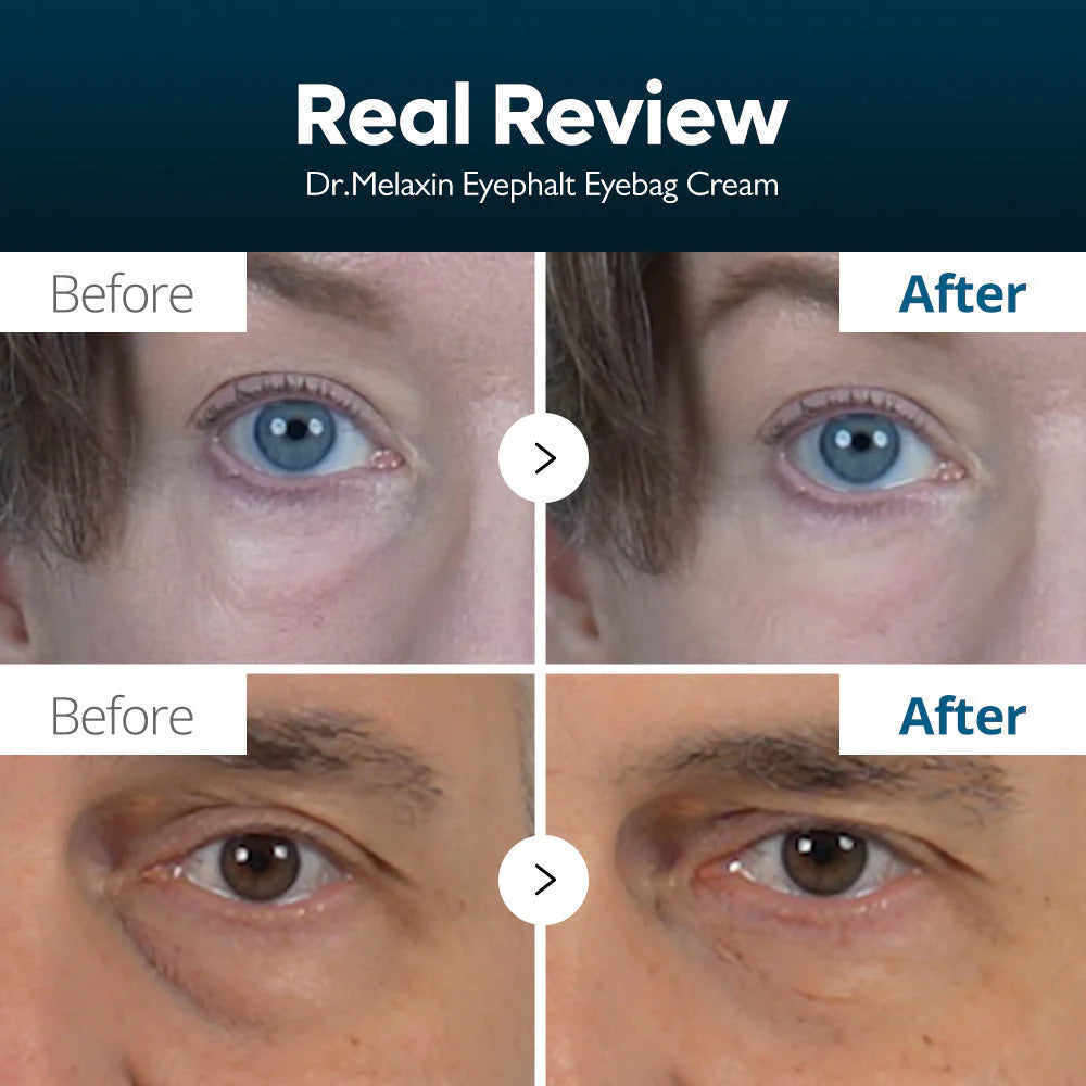 Dr. Melaxin Eyephalt Eyebag Cream – Under Eye Bag Remover, Dark Circle & Wrinkle Repair Eye Cream